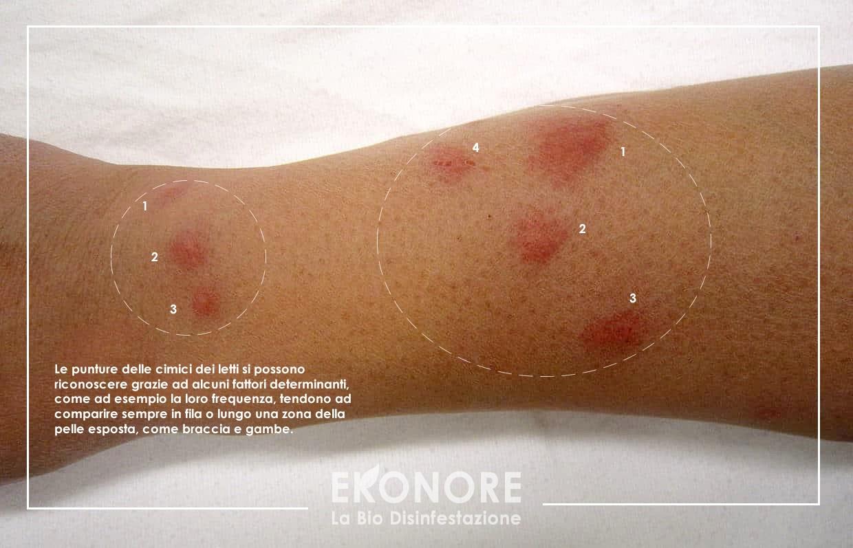 Cimici Del Letto Come Eliminarle