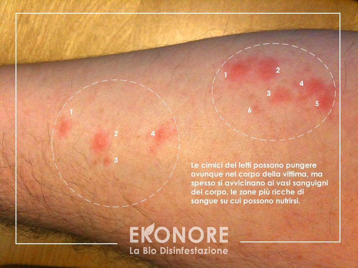 Come Distruggere Le Cimici Da Letto