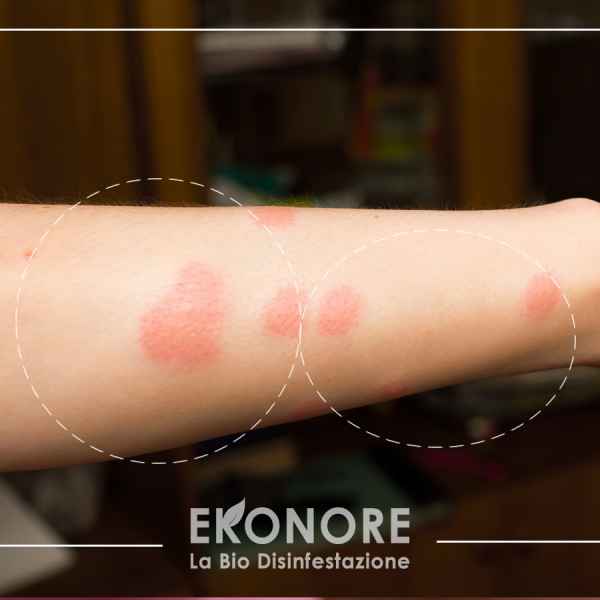 Riconoscere le punture delle pulci