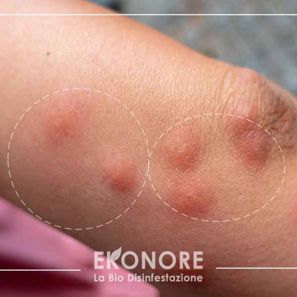 Riconoscere le punture delle pulci