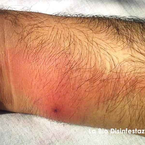 Punture zecche del piccione come riconoscerle