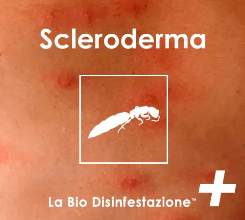 Punture da scleroderma domestico